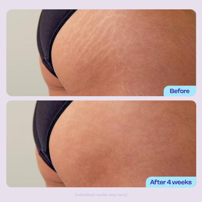 "DREAMISCULPT" Body Tightening & Sculpting Cream