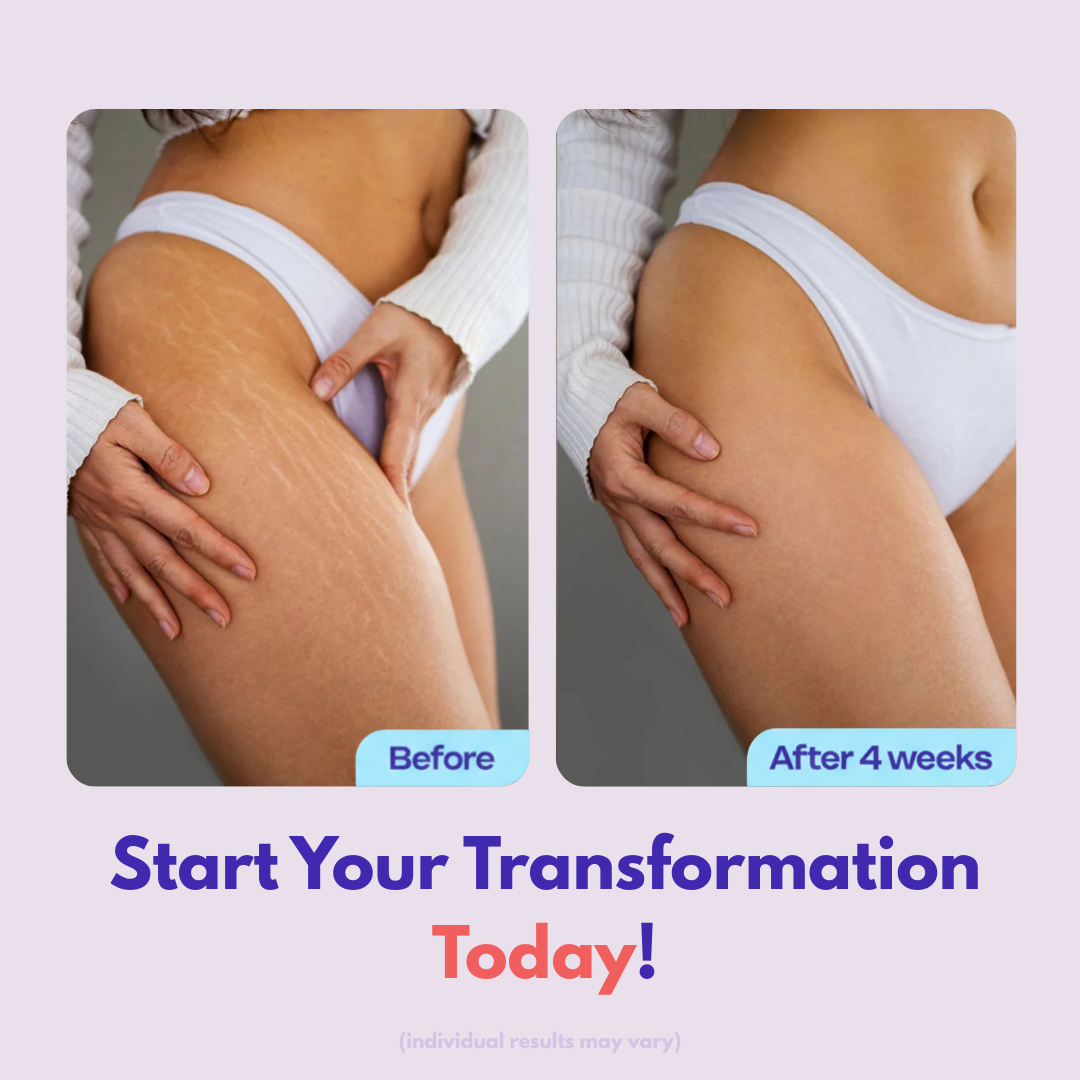 "DREAMISCULPT" Body Tightening & Sculpting Cream