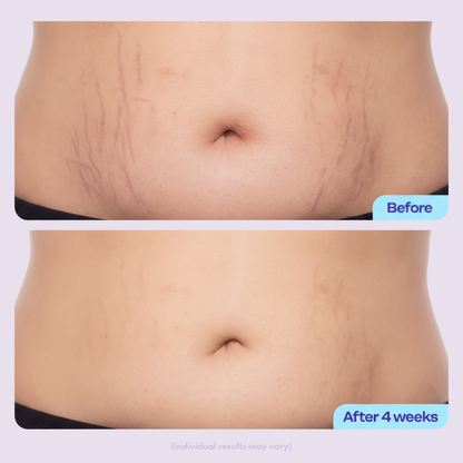 "DREAMISCULPT" Body Tightening & Sculpting Cream